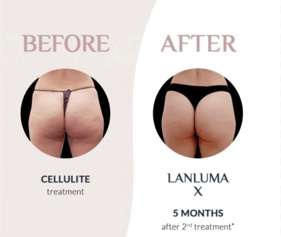 1000079378