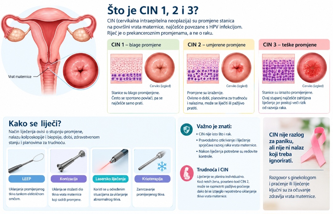 Što je CIN 1, CIN 2 i CIN 3? Kako nastaju promjene na vratu maternice i kako se liječe?